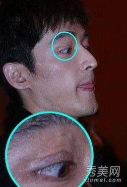 脸上有疤明星